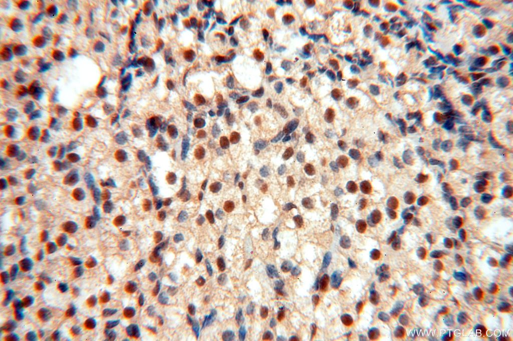 Immunohistochemistry (IHC) staining of human ovary tissue using MCL1L-specific Polyclonal antibody (15825-1-AP)