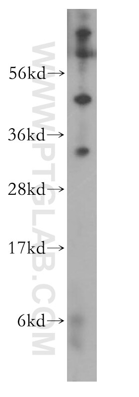 MCL1L-specific