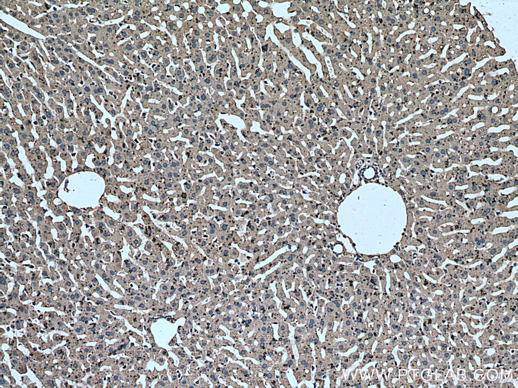 Immunohistochemistry (IHC) staining of mouse liver tissue using Mcp1 Monoclonal antibody (66272-1-Ig)