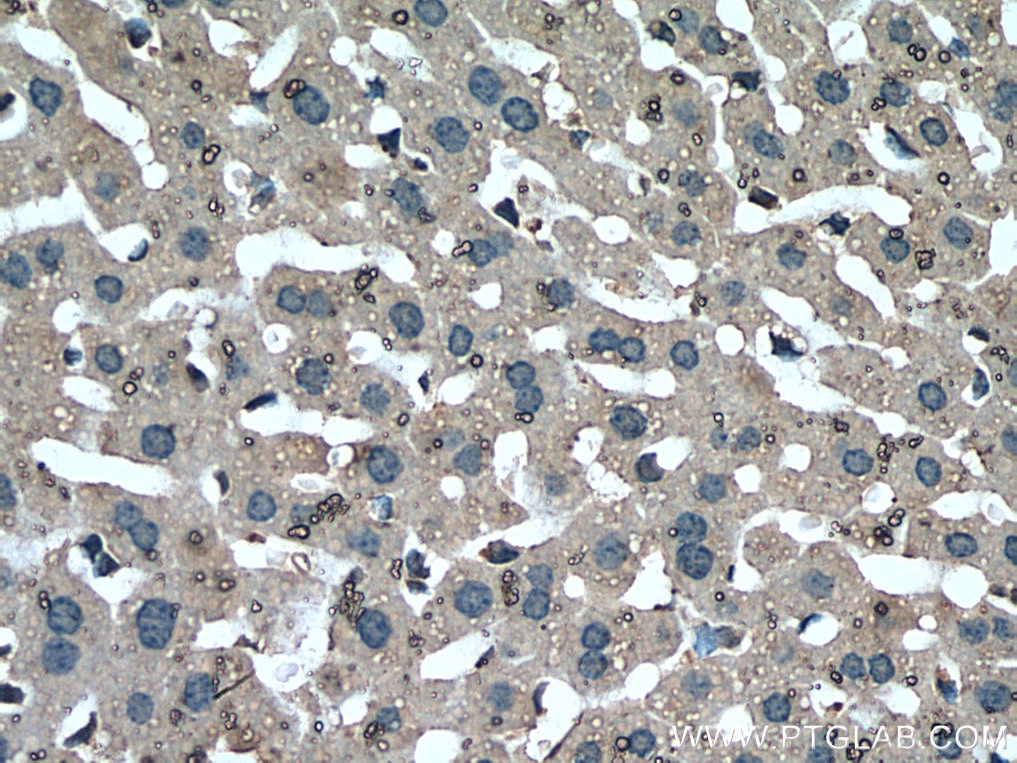 Immunohistochemistry (IHC) staining of mouse liver tissue using Mcp1 Monoclonal antibody (66272-1-Ig)