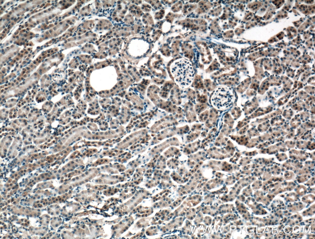 Immunohistochemistry (IHC) staining of mouse kidney tissue using Mcp1 Monoclonal antibody (66272-1-Ig)