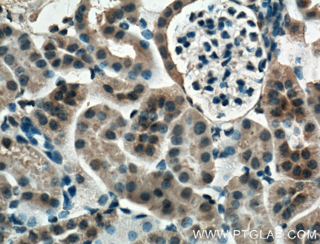 Immunohistochemistry (IHC) staining of mouse kidney tissue using Mcp1 Monoclonal antibody (66272-1-Ig)
