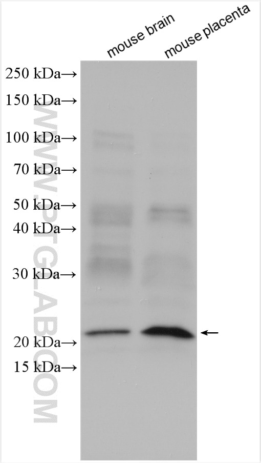 Western Blot (WB) analysis of various lysates using Mcp1 Monoclonal antibody (66272-1-Ig)