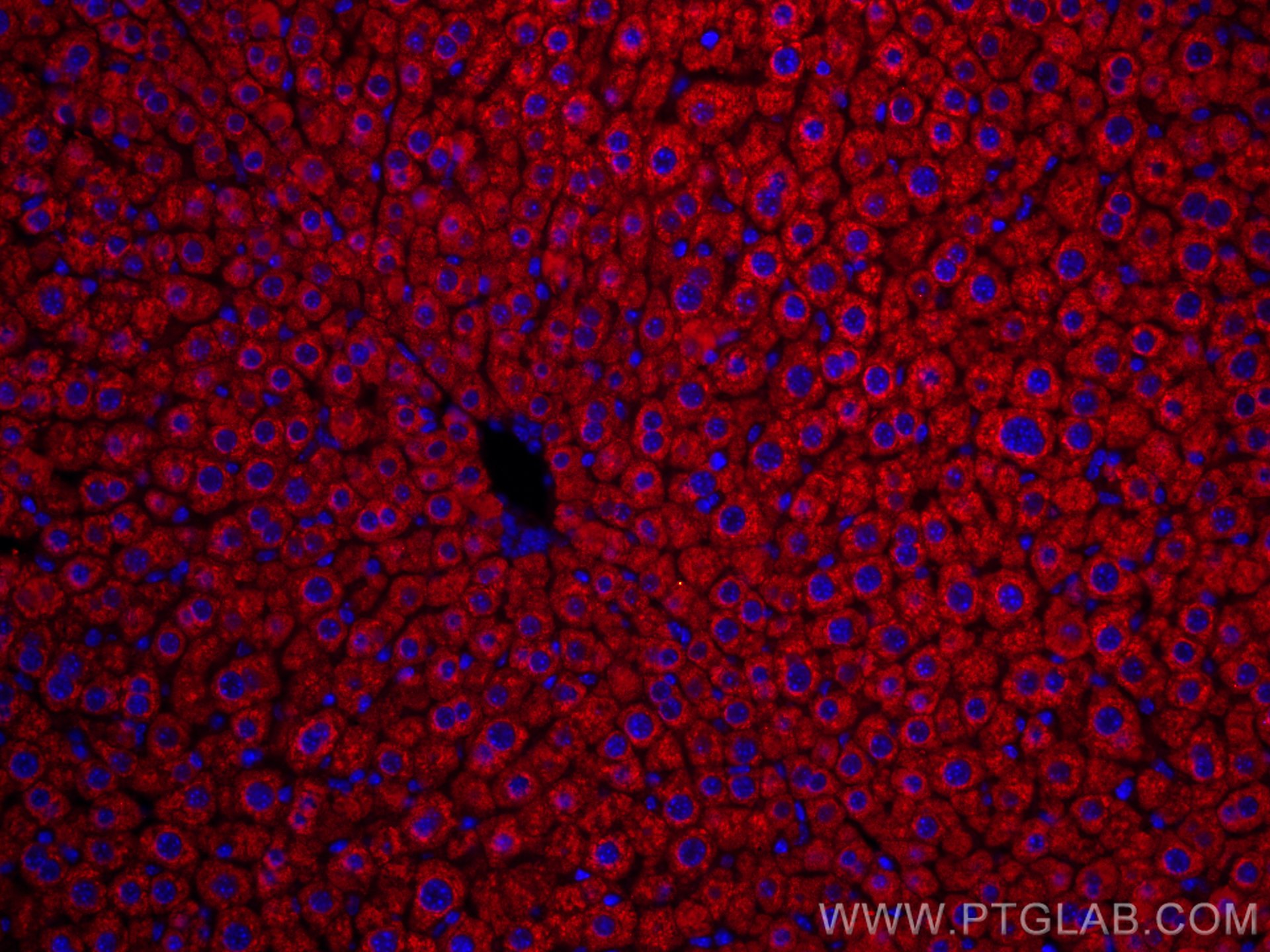 Immunofluorescence (IF) / fluorescent staining of mouse liver tissue using CoraLite®594-conjugated Mcp1 Monoclonal antibody (CL594-66272)