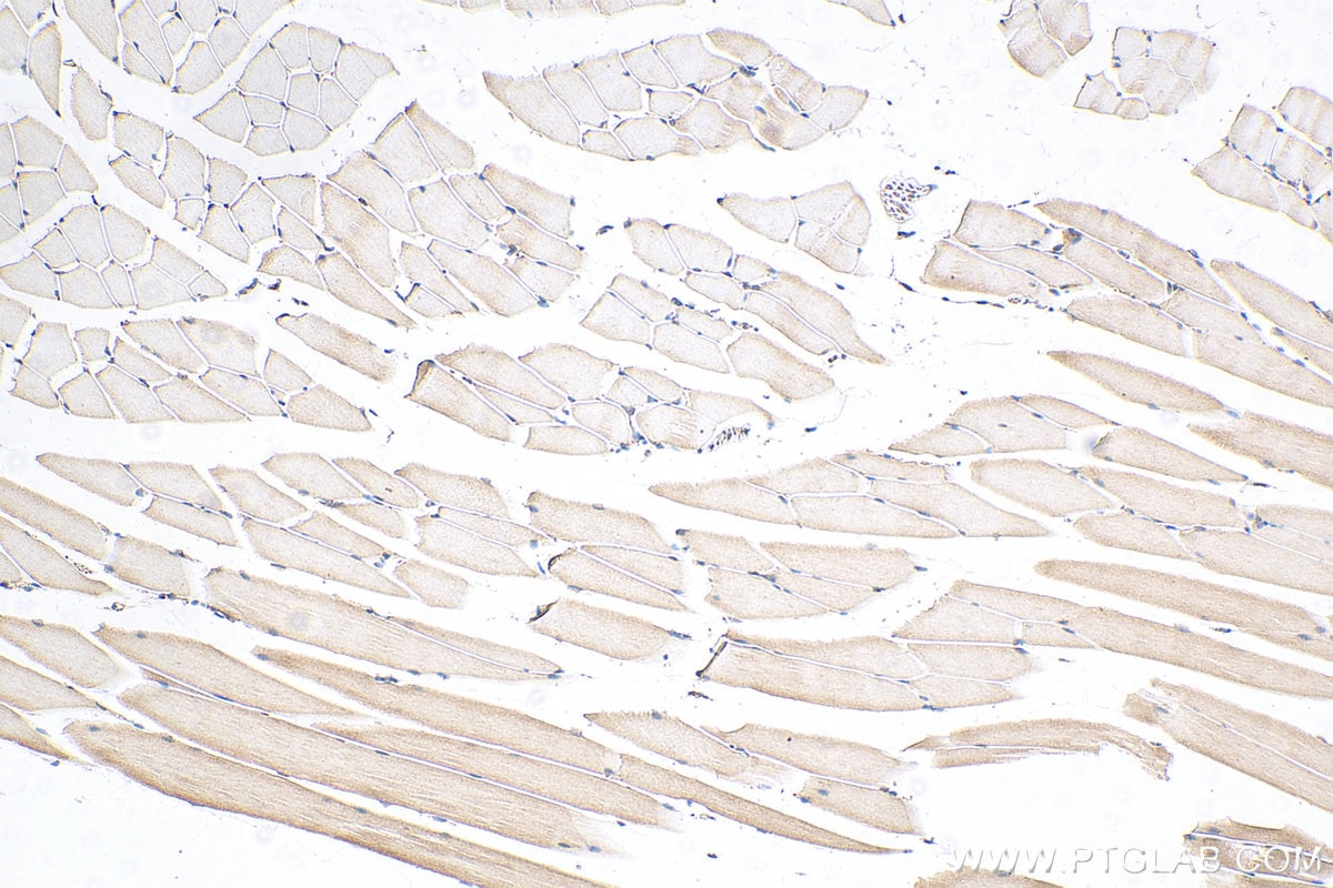 Immunohistochemistry (IHC) staining of mouse skeletal muscle tissue using Mecr Polyclonal antibody (51025-2-Ig)