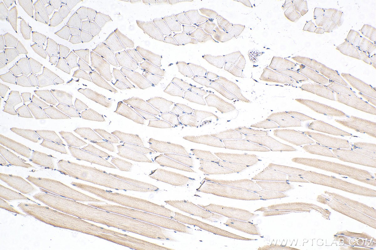 Immunohistochemistry (IHC) staining of mouse skeletal muscle tissue using MECR Polyclonal antibody (51025-2-Ig)