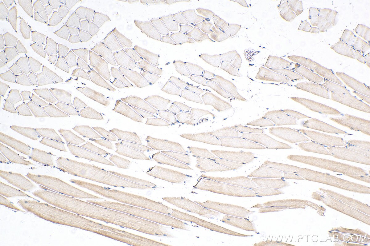 Immunohistochemistry (IHC) staining of mouse skeletal muscle tissue using Mecr Polyclonal antibody (51025-2-Ig)