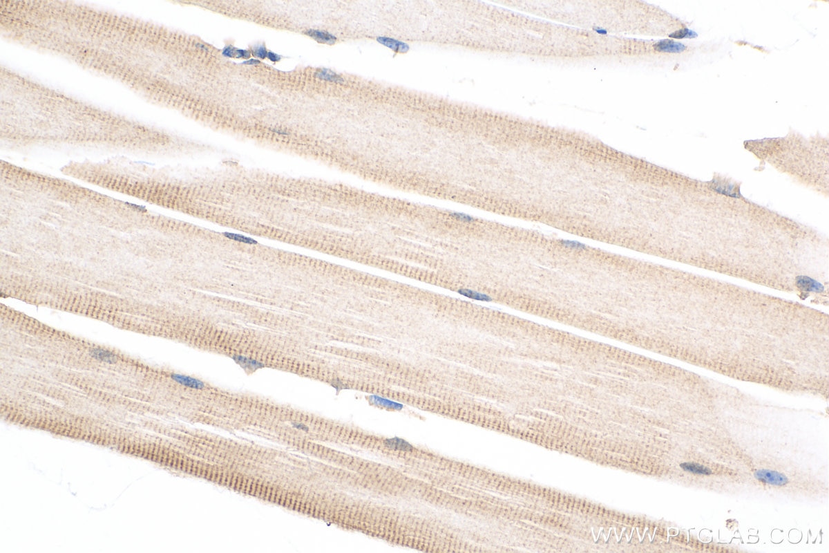 Immunohistochemistry (IHC) staining of mouse skeletal muscle tissue using Mecr Polyclonal antibody (51025-2-Ig)