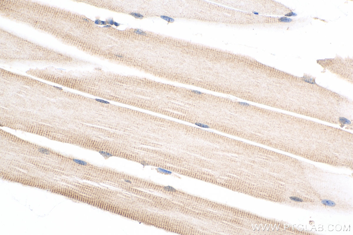 Immunohistochemistry (IHC) staining of mouse skeletal muscle tissue using MECR Polyclonal antibody (51025-2-Ig)