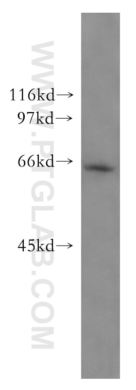 Western Blot (WB) analysis of mouse skeletal muscle tissue using MECR Polyclonal antibody (51025-2-Ig)