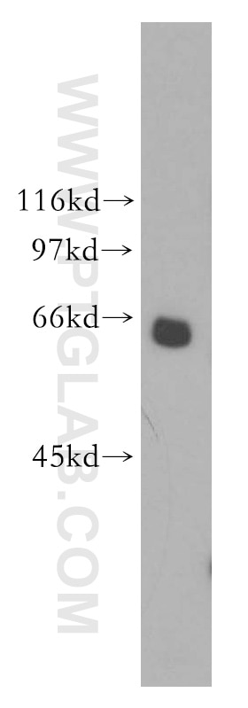 Western Blot (WB) analysis of mouse heart tissue using Mecr Polyclonal antibody (51025-2-Ig)