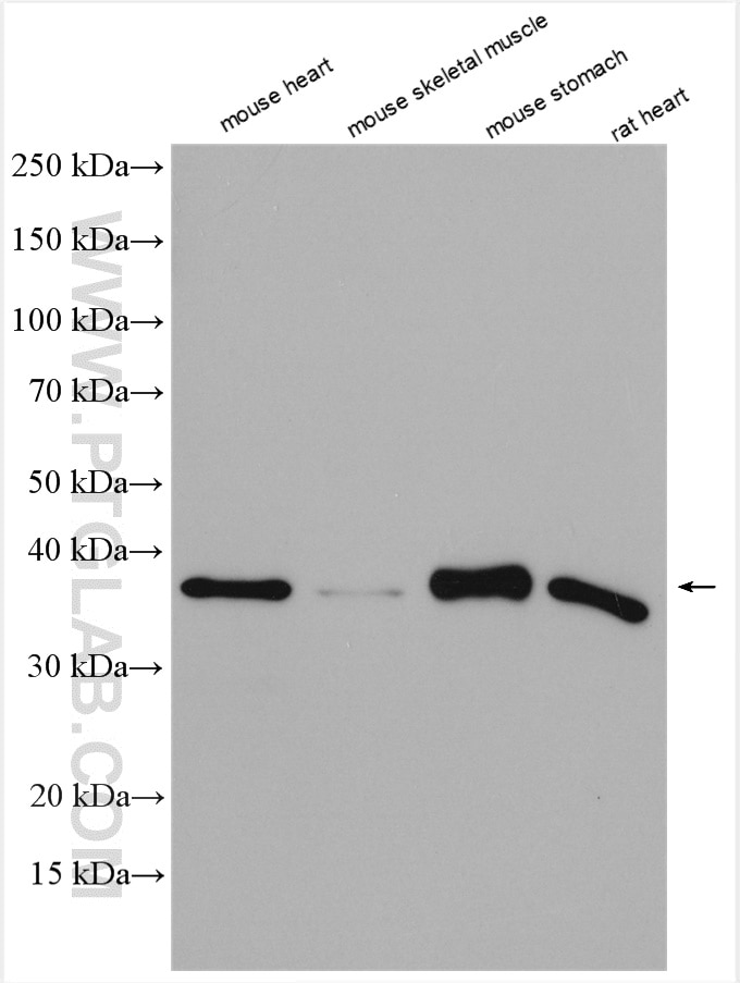 Western Blot (WB) analysis of various lysates using Mecr Polyclonal antibody (51027-2-AP)