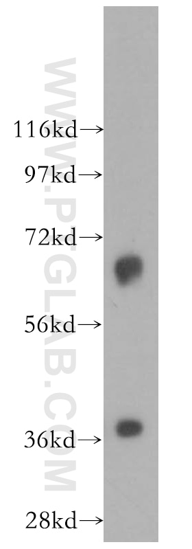 Western Blot (WB) analysis of mouse heart tissue using Mecr Polyclonal antibody (51027-2-AP)