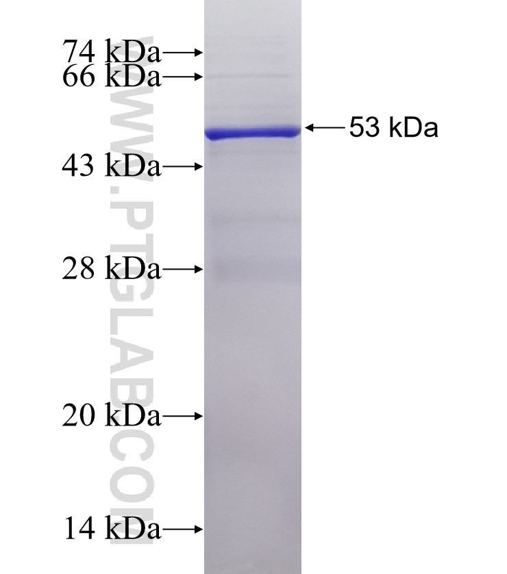 Mecr fusion protein Ag0465 SDS-PAGE