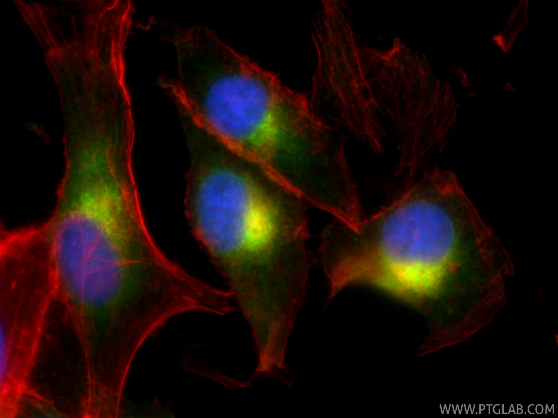 IF Staining of SK-MEL-28 using 87351-4-RR Immunofluorescence (IF) / fluorescent staining of SK-MEL-28 cells using Melan-A Recombinant monoclonal antibody (87351-4-RR)