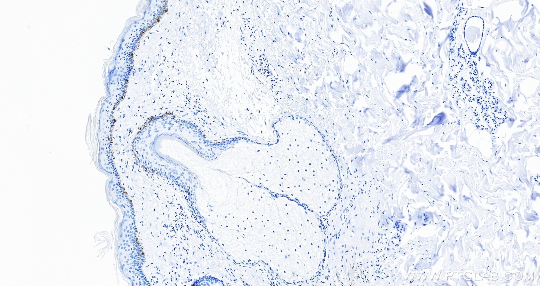 IHC staining of human skin using 87351-4-RR (same clone as 87351-4-PBS) Immunohistochemistry (IHC) staining of human skin tissue using Melan-A Recombinant monoclonal antibody (87351-4-RR)