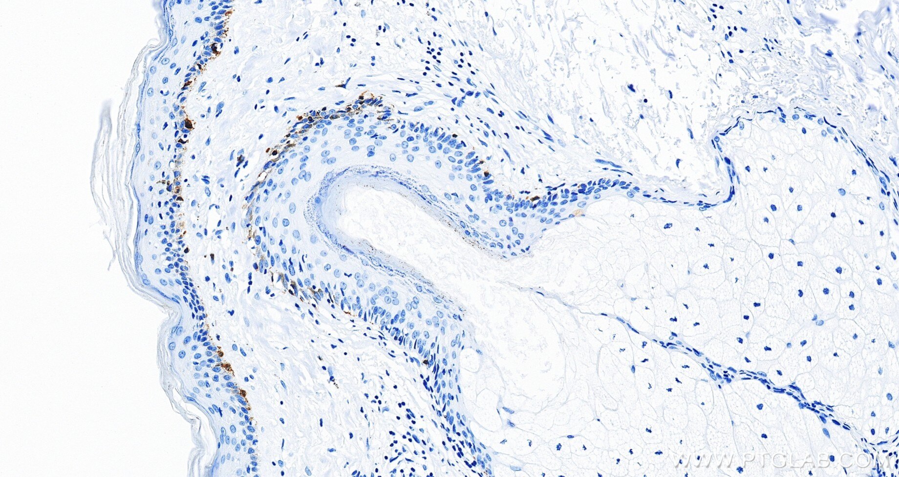 IHC staining of human skin using 87351-4-RR (same clone as 87351-4-PBS) Immunohistochemistry (IHC) staining of human skin tissue using Melan-A Recombinant monoclonal antibody (87351-4-RR)
