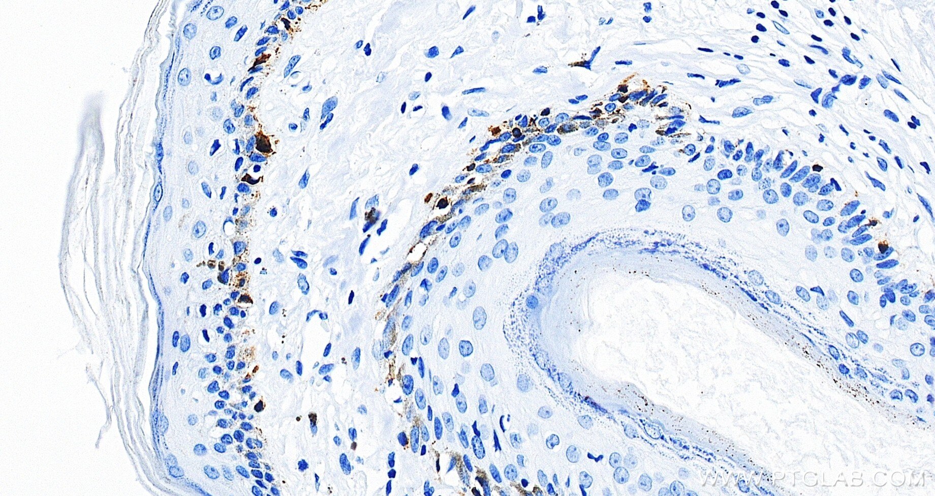 IHC staining of human skin using 87351-4-RR (same clone as 87351-4-PBS) Immunohistochemistry (IHC) staining of human skin tissue using Melan-A Recombinant monoclonal antibody (87351-4-RR)