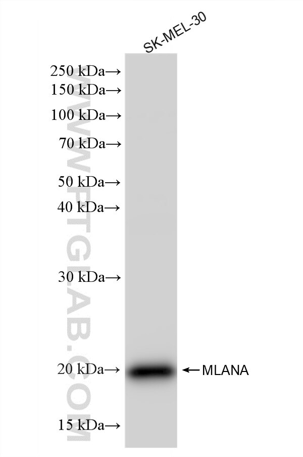 WB analysis of SK-MEL-30 using 87351-4-RR (same clone as 87351-4-PBS) Western Blot (WB) analysis of SK-MEL-30 cells using Melan-A Recombinant monoclonal antibody (87351-4-RR)