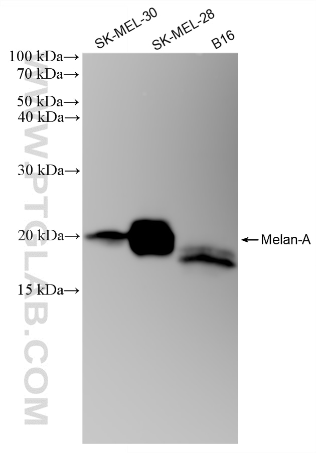 WB analysis using 87351-4-RR Western Blot (WB) analysis of various lysates using Melan-A Recombinant monoclonal antibody (87351-4-RR)