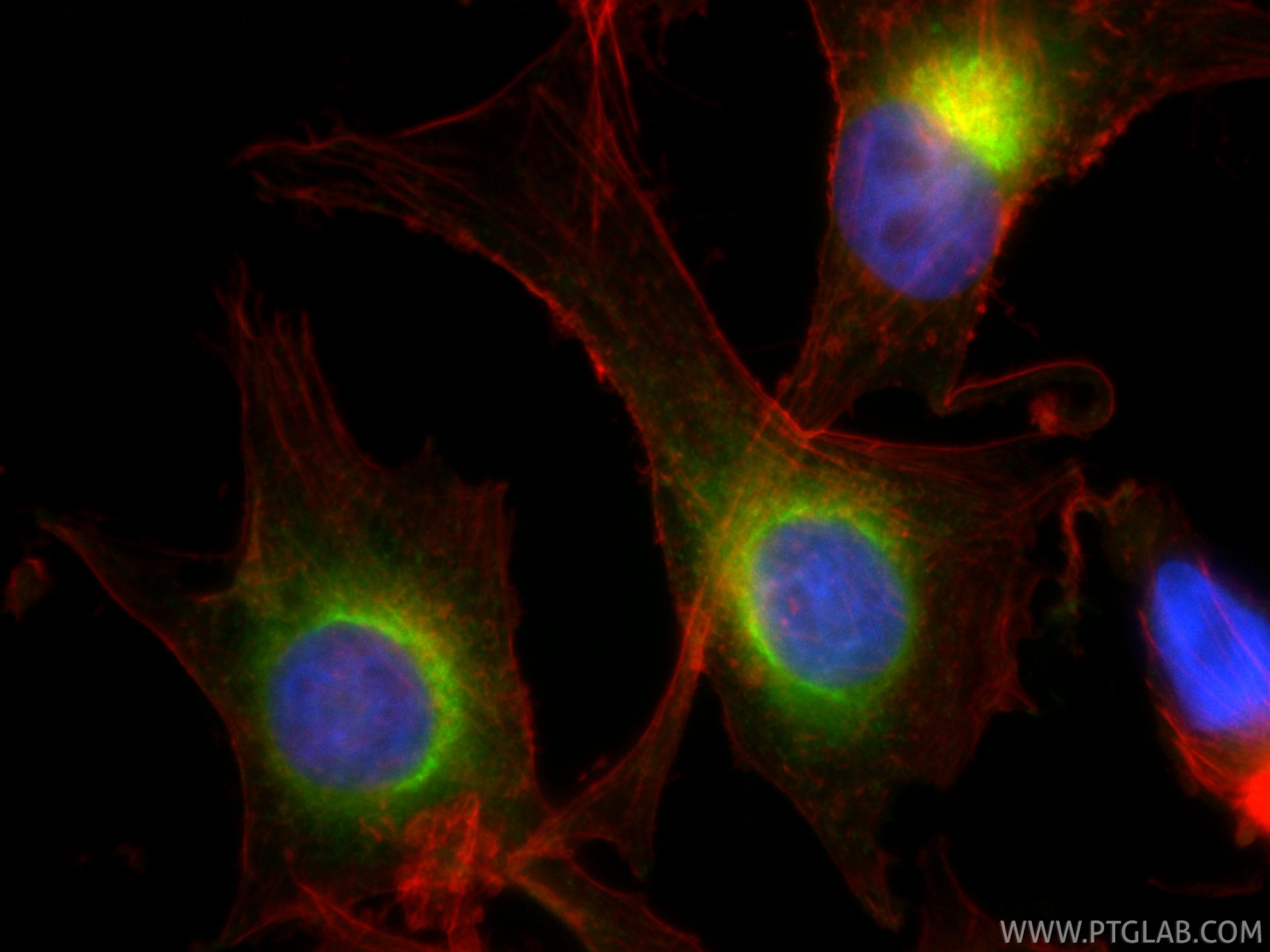 IF Staining of SK-MEL-28 using CL488-87351-4 Immunofluorescence (IF) / fluorescent staining of SK-MEL-28 cells using CoraLite® Plus 488-conjugated Melan-A Recombinant (CL488-87351-4)