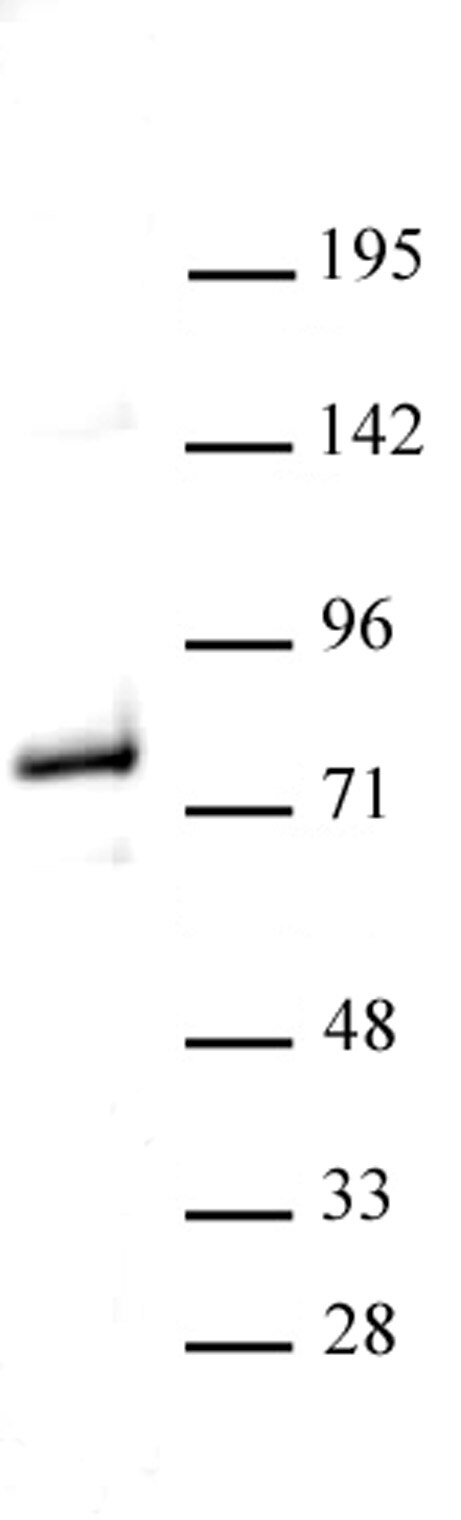 Western blot of Menin antibody. Nuclear extract of HEK293 cells (20 μg) probed with Menin antibody (1:1,000).