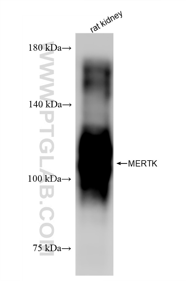 WB analysis using 87457-2-RR (same clone as 87457-2-PBS) Western Blot (WB) analysis of various lysates using Mertk Recombinant monoclonal antibody (87457-2-RR)