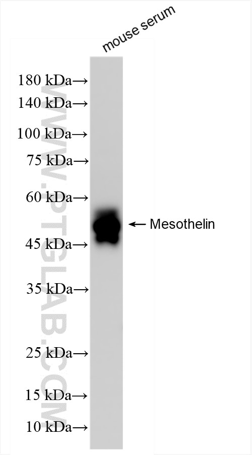mouse serum were subjected to SDS PAGE followed by western blot with 85774-4-RR (Msln antibody) at dilution of 1:5000 incubated at room temperature for 1.5 hours. Western Blot (WB) analysis of mouse serum using Mesothelin Recombinant antibody (85774-4-RR)