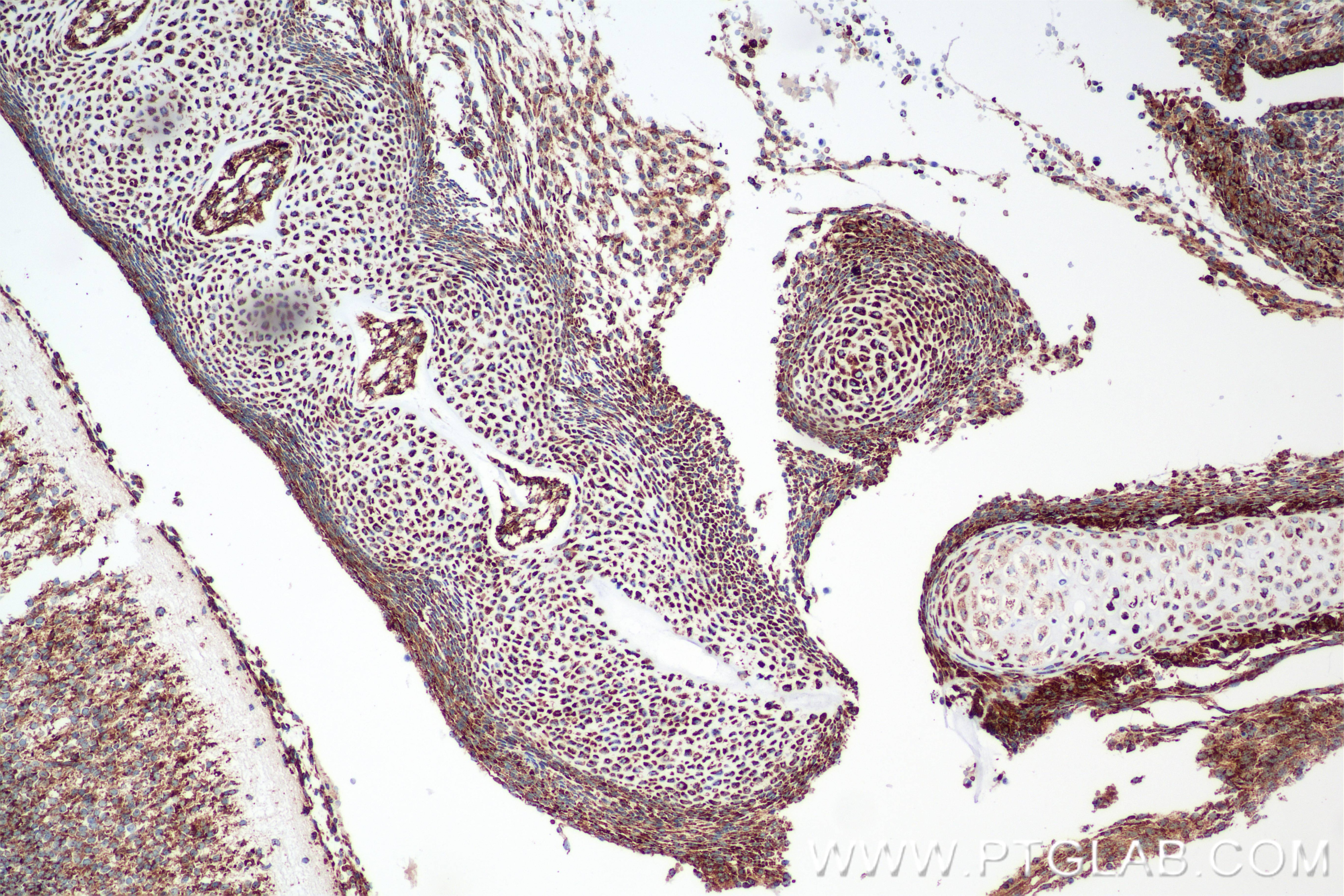 Immunohistochemistry (IHC) staining of mouse embryo tissue using Midkine Recombinant antibody (84815-1-RR)