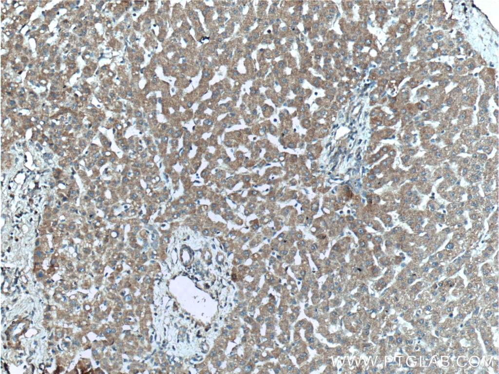 Immunohistochemistry (IHC) staining of human liver tissue using Mitoferrin 1 Polyclonal antibody (26469-1-AP)