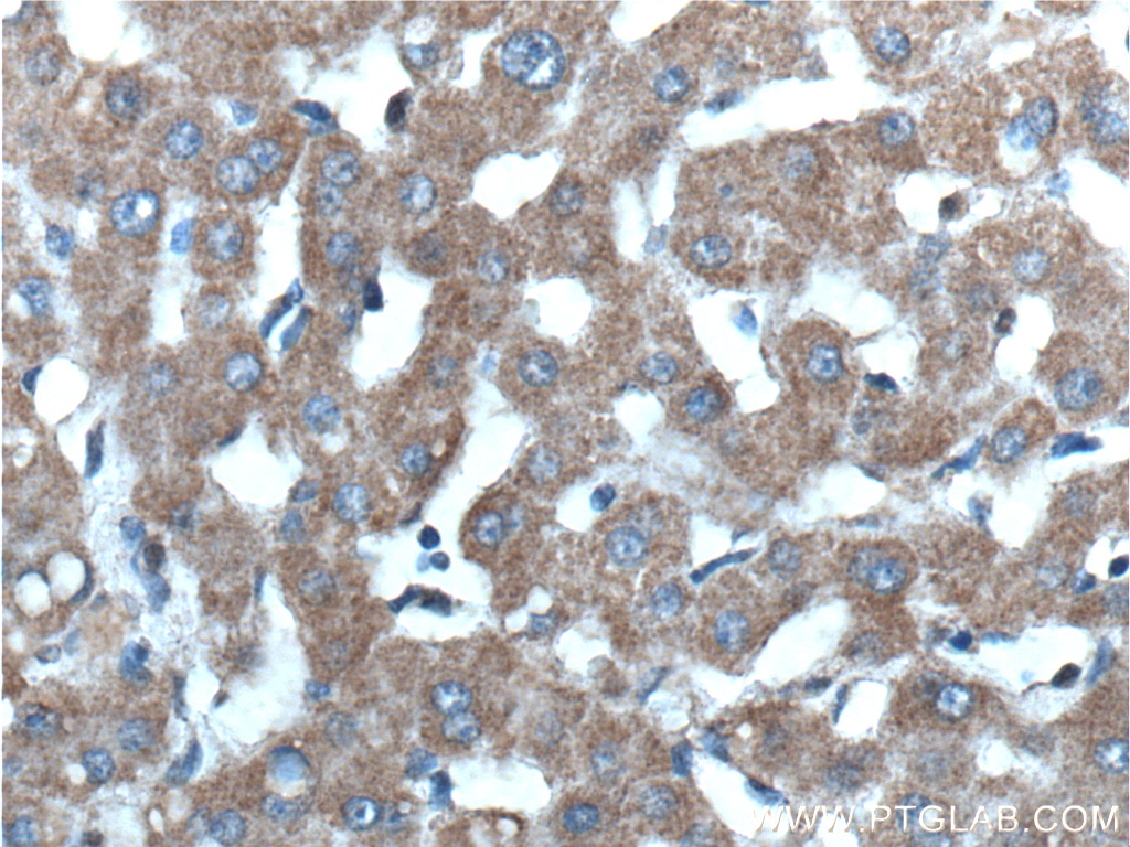 Immunohistochemistry (IHC) staining of human liver tissue using Mitoferrin 1 Polyclonal antibody (26469-1-AP)