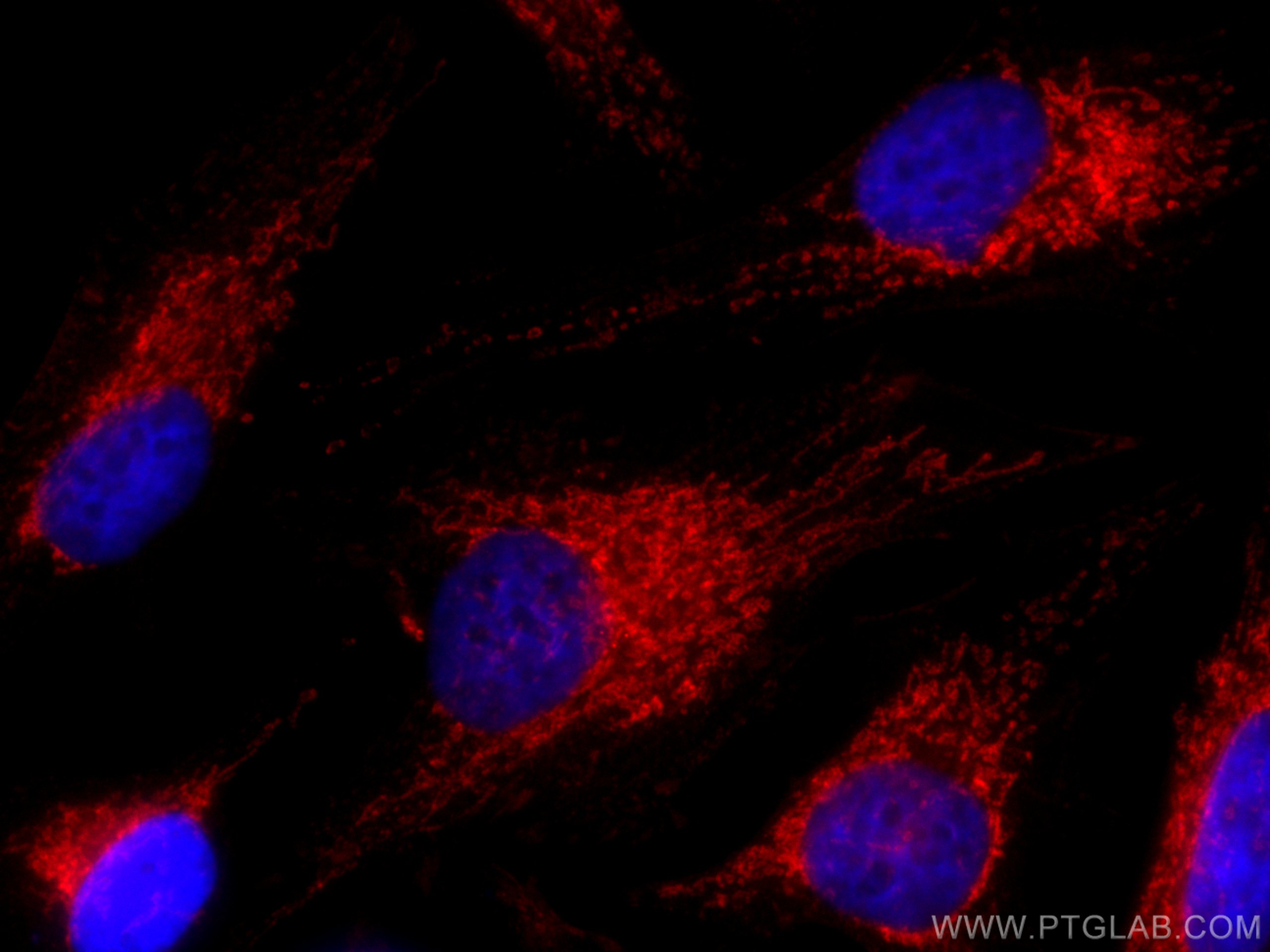 Immunofluorescence (IF) / fluorescent staining of HeLa cells using CoraLite®594-conjugated Mitofilin Polyclonal antib (CL594-10179)