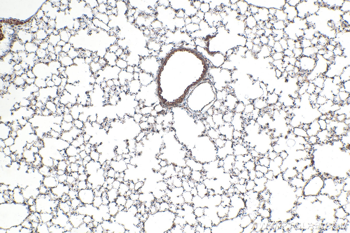IHC staining of mouse lung using 30145-1-AP Immunohistochemistry (IHC) staining of mouse lung tissue using MLKL Polyclonal antibody (30145-1-AP)