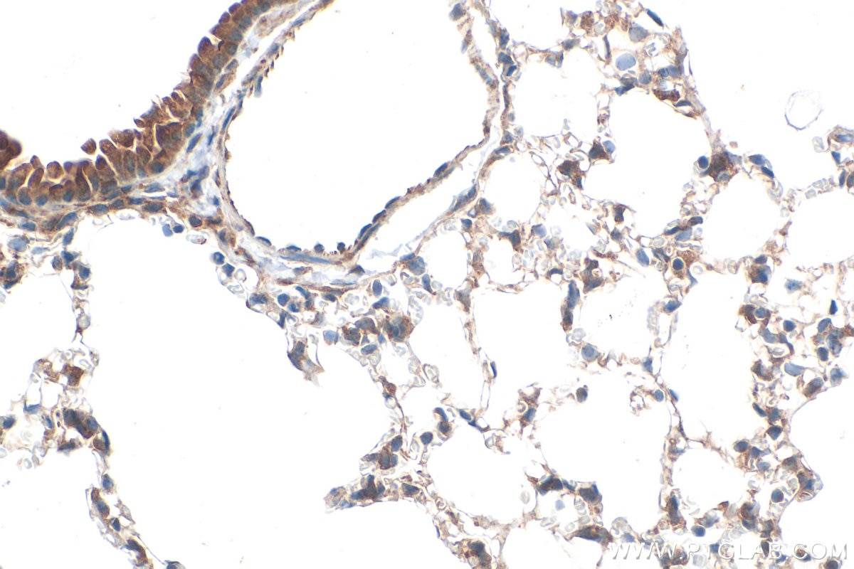 IHC staining of mouse lung using 30145-1-AP Immunohistochemistry (IHC) staining of mouse lung tissue using MLKL Polyclonal antibody (30145-1-AP)