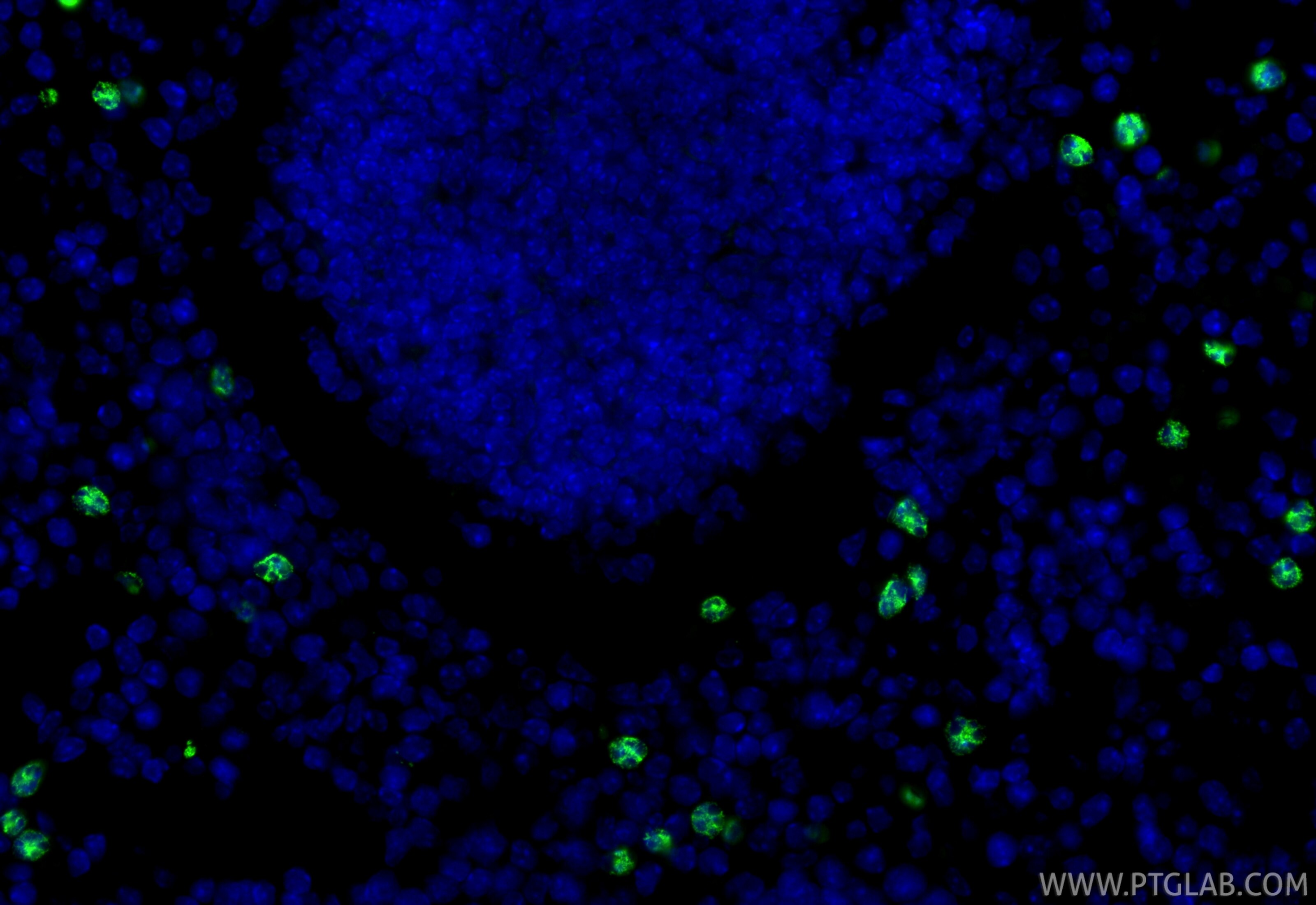 Immunofluorescent analysis of (4% PFA) fixed paraffin-embedded mouse spleen tissue using Mmp8 antibody (33084-1-AP) at dilution of 1:200 and CoraLite®488-Conjugated Goat Anti-Rabbit IgG(H+L) (SA00013-2). Heat mediated antigen retrieval with Tris-EDTA buffer (pH 9.0). Immunofluorescence (IF) / fluorescent staining of mouse spleen tissue using Mmp8 Polyclonal antibody (33084-1-AP)