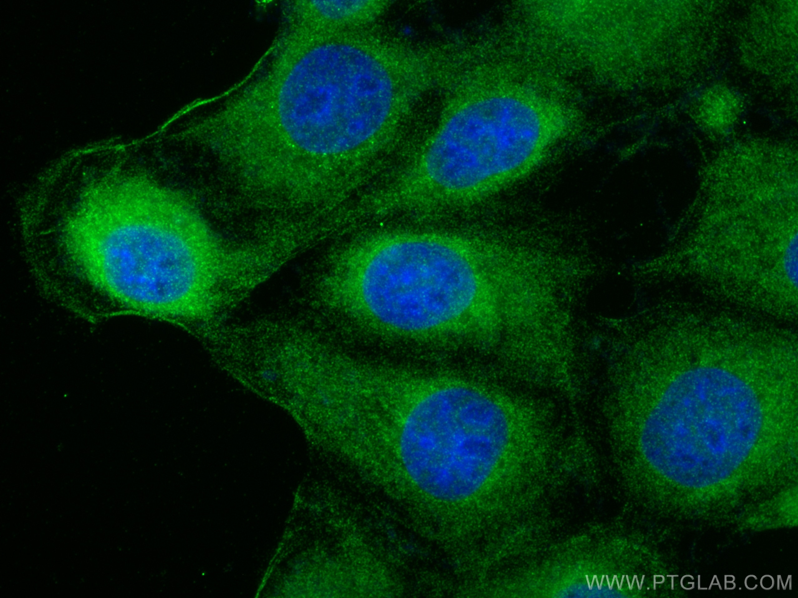 Immunofluorescence (IF) / fluorescent staining of A431 cells using Mmp9 Polyclonal antibody (30592-1-AP)