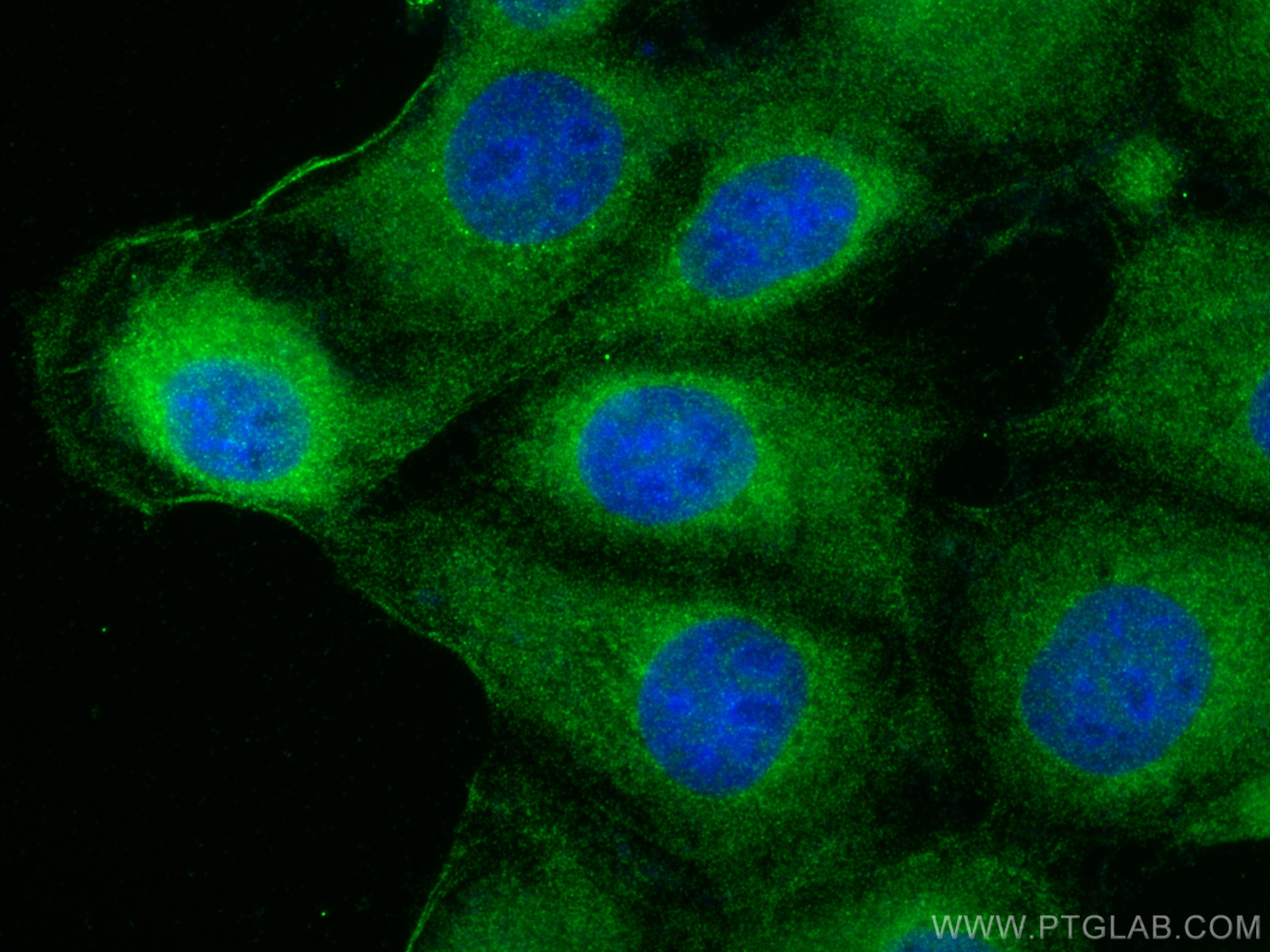 IF Staining of A431 using 30592-1-AP