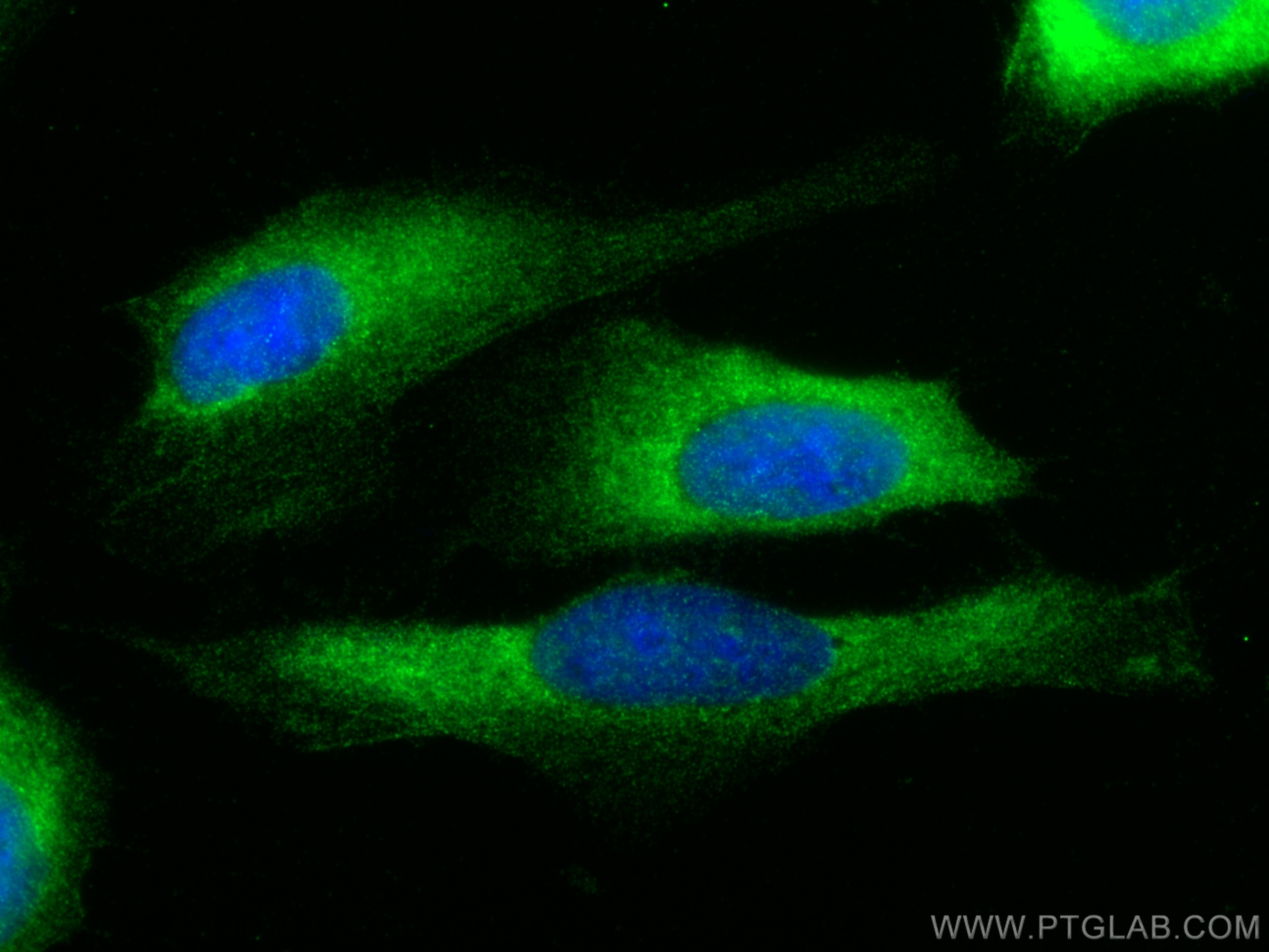 Immunofluorescence (IF) / fluorescent staining of U2OS cells using Mmp9 Polyclonal antibody (30592-1-AP)