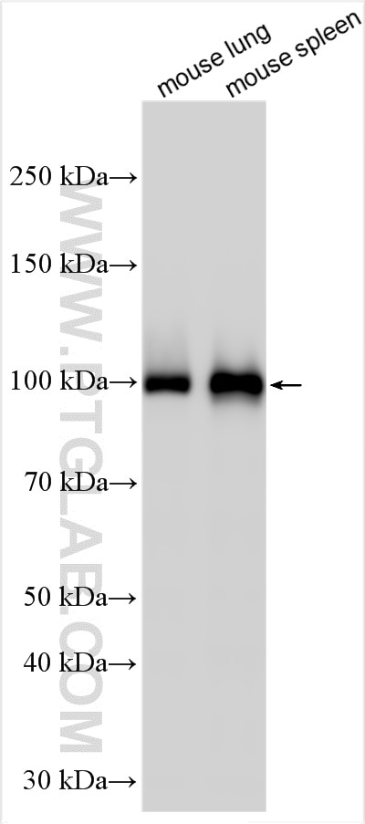 Western Blot (WB) analysis of various lysates using Mmp9 Polyclonal antibody (30592-1-AP)