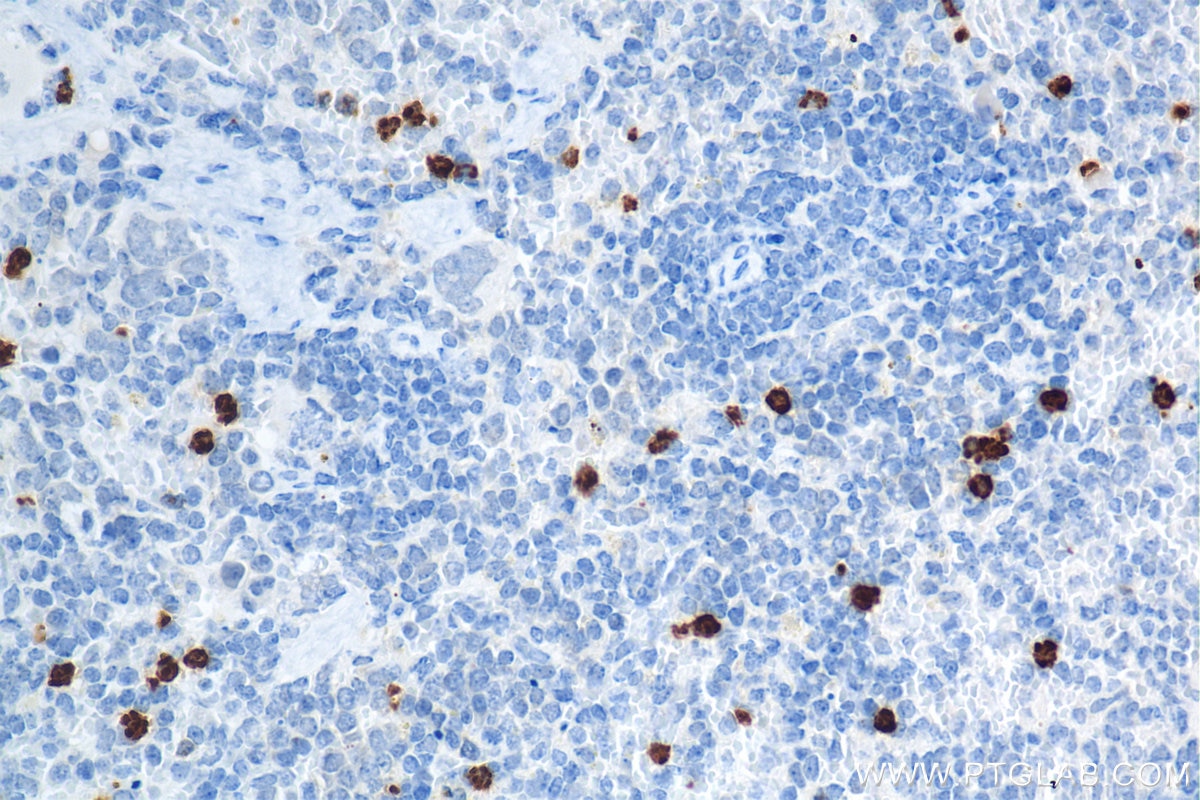 Immunohistochemistry (IHC) staining of mouse spleen tissue using Mmp9 Recombinant antibody (82854-5-RR)