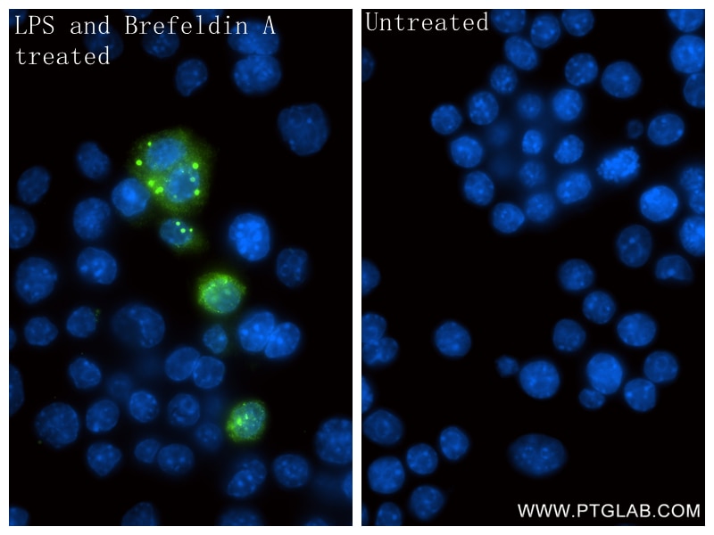 IF Staining of RAW 264.7 using 82854-8-RR Immunofluorescence (IF) / fluorescent staining of RAW 264.7 cells using Mmp9 Recombinant monoclonal antibody (82854-8-RR)