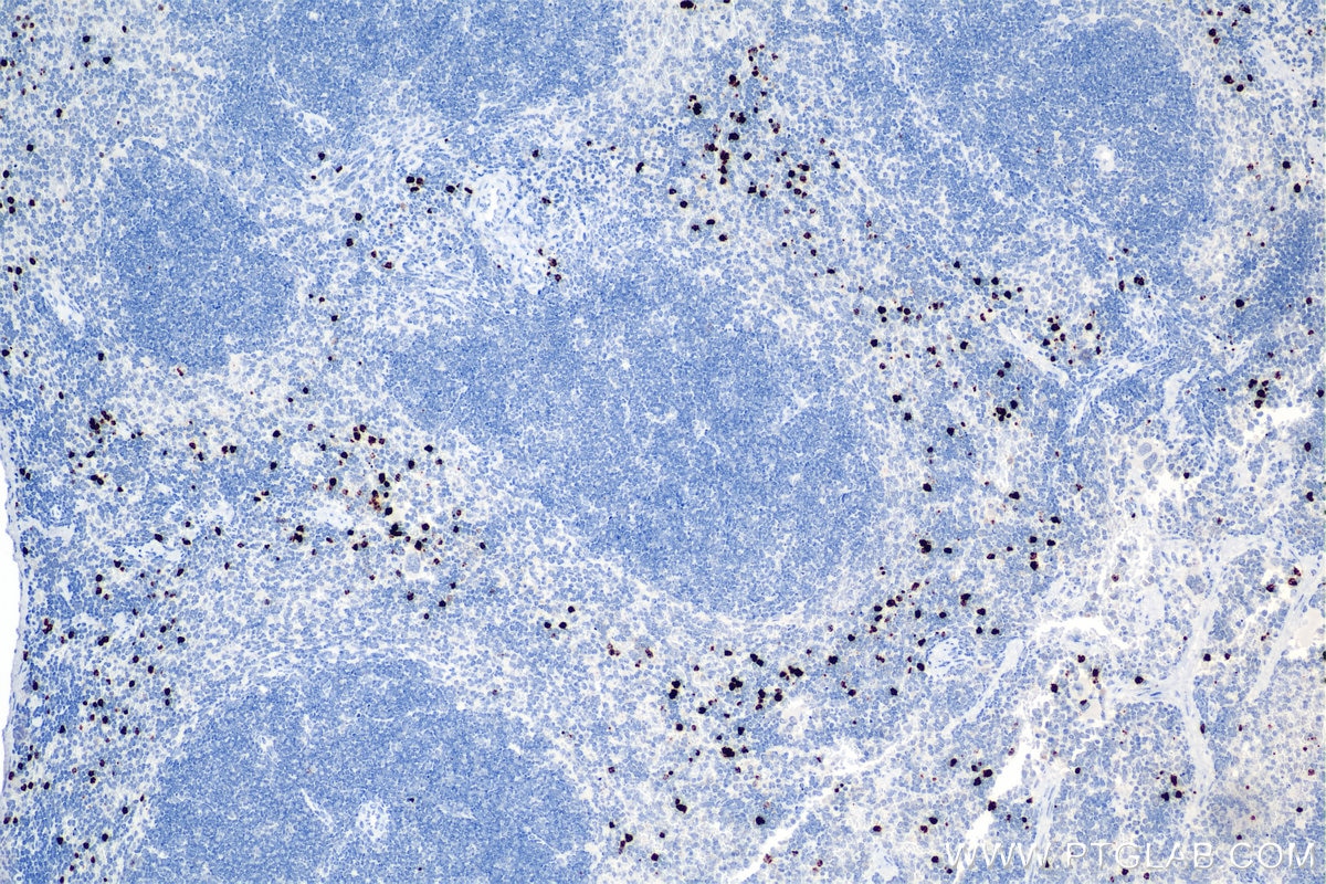 Immunohistochemistry (IHC) staining of mouse spleen tissue using Mmp9 Recombinant antibody (82854-8-RR)