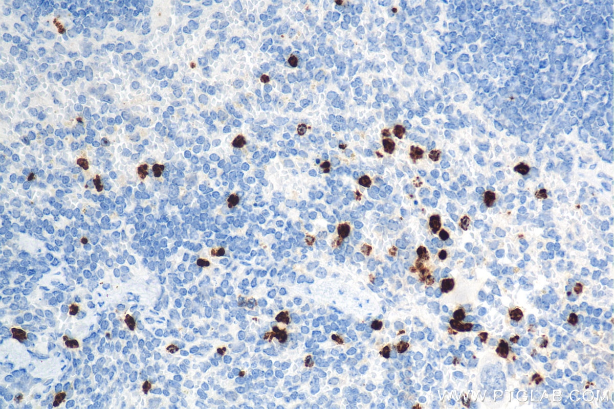 Immunohistochemistry (IHC) staining of mouse spleen tissue using Mmp9 Recombinant antibody (82854-8-RR)