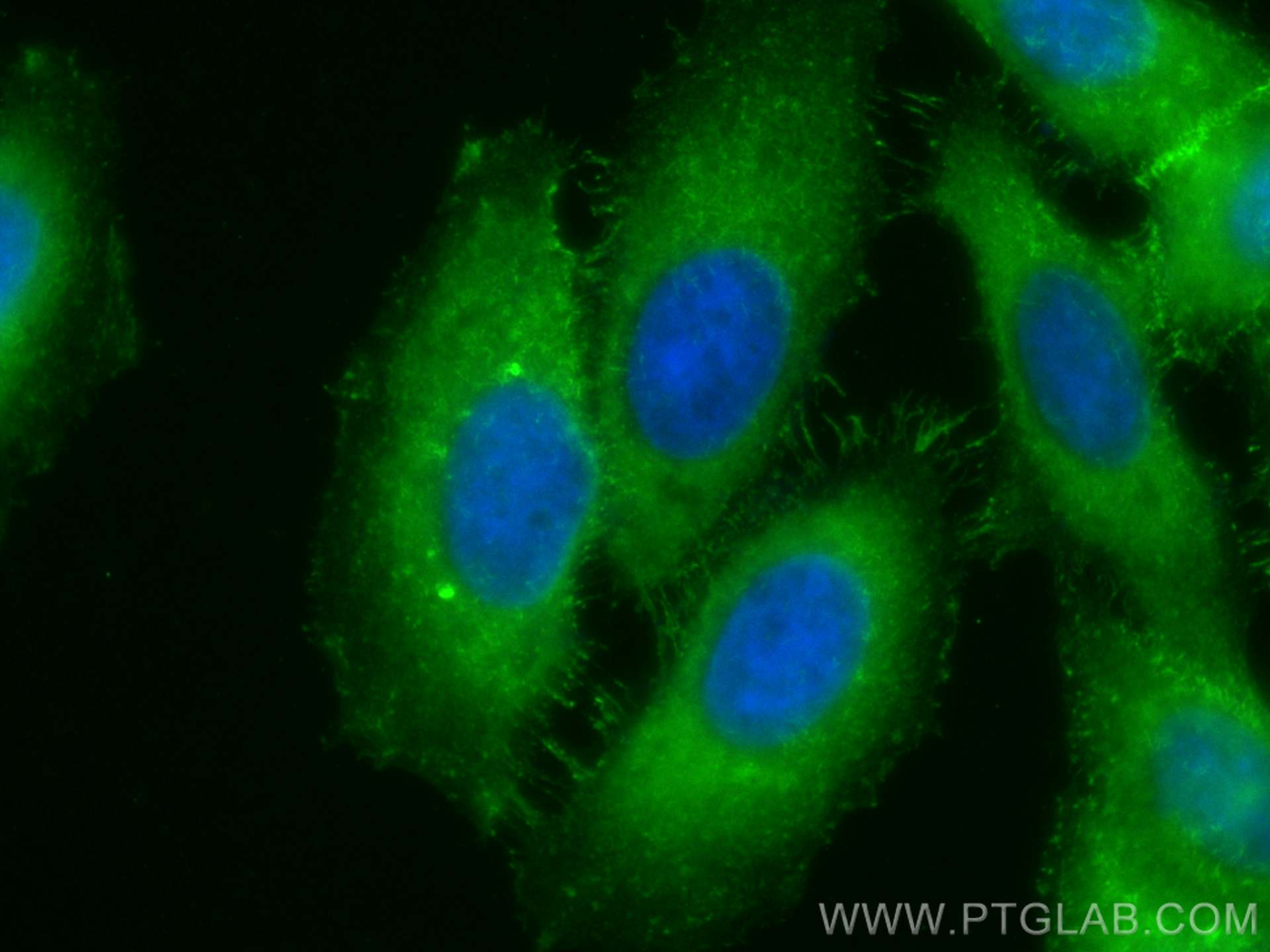 Immunofluorescence (IF) / fluorescent staining of HepG2 cells using CoraLite® Plus 488-conjugated Moesin Polyclonal an (CL488-26053)