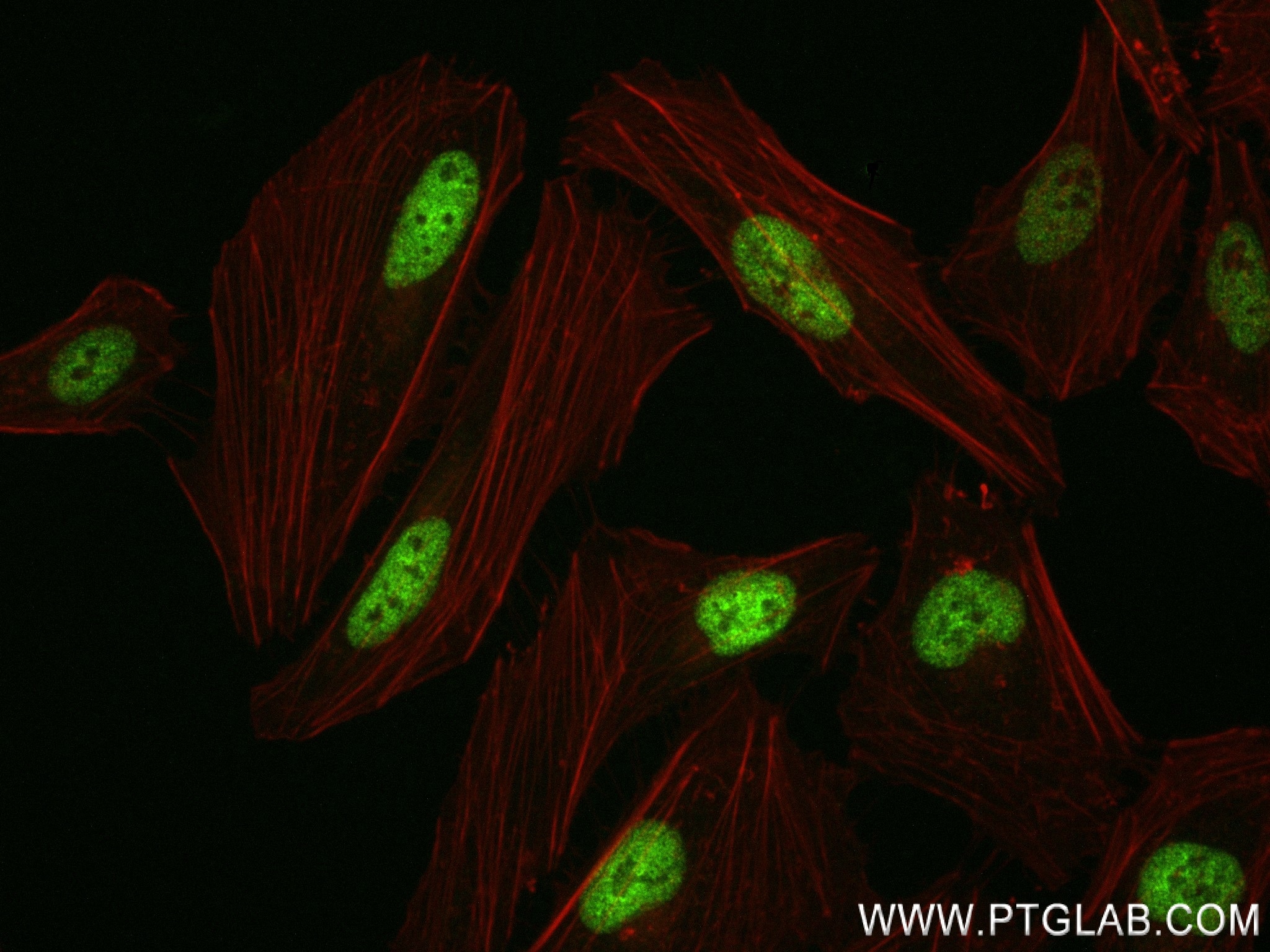 IF Staining of HeLa using 84747-1-RR Immunofluorescence (IF) / fluorescent staining of HeLa cells using Mono/Di-Methyl-Histone H3 (Lys4) Recombinant monoc (84747-1-RR)