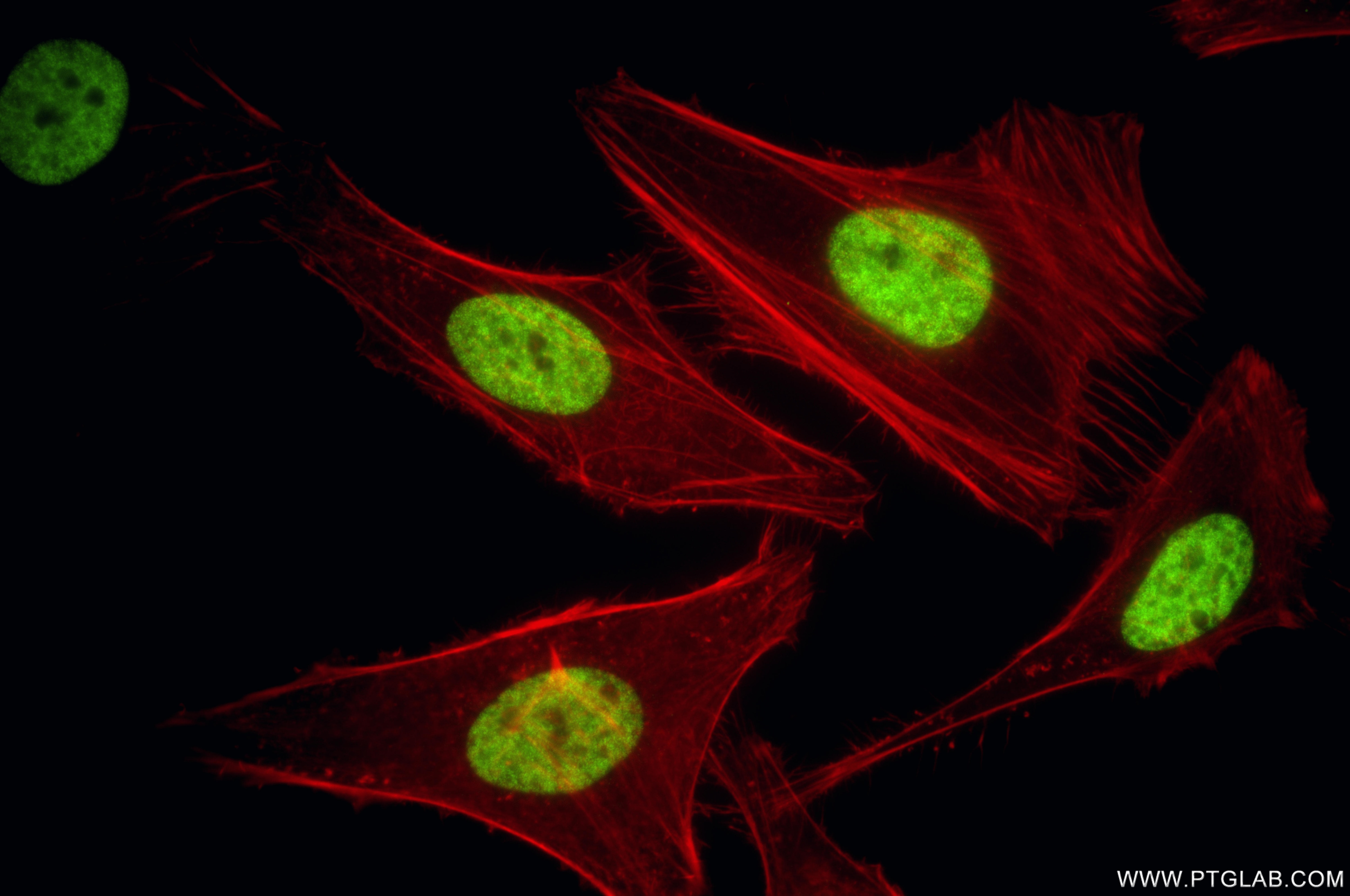 Immunofluorescence (IF) / fluorescent staining of HeLa cells using Mono/Di-Methyl-Histone H3 (Lys9) Recombinant monoc (86990-1-RR)