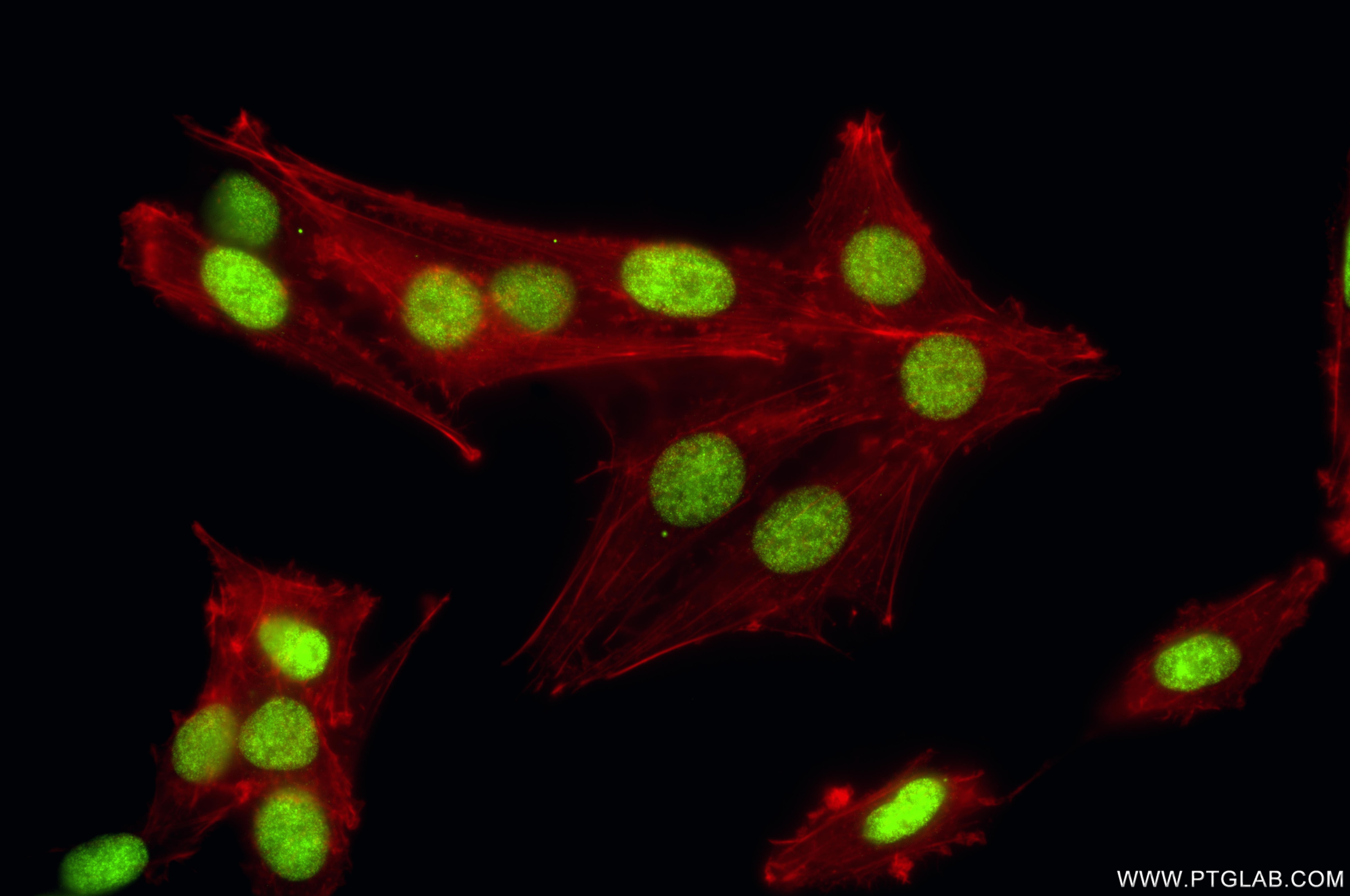 Immunofluorescence (IF) / fluorescent staining of C6 cells using Mono/Di-Methyl-Histone H3 (Lys9) Recombinant monoc (86990-1-RR)