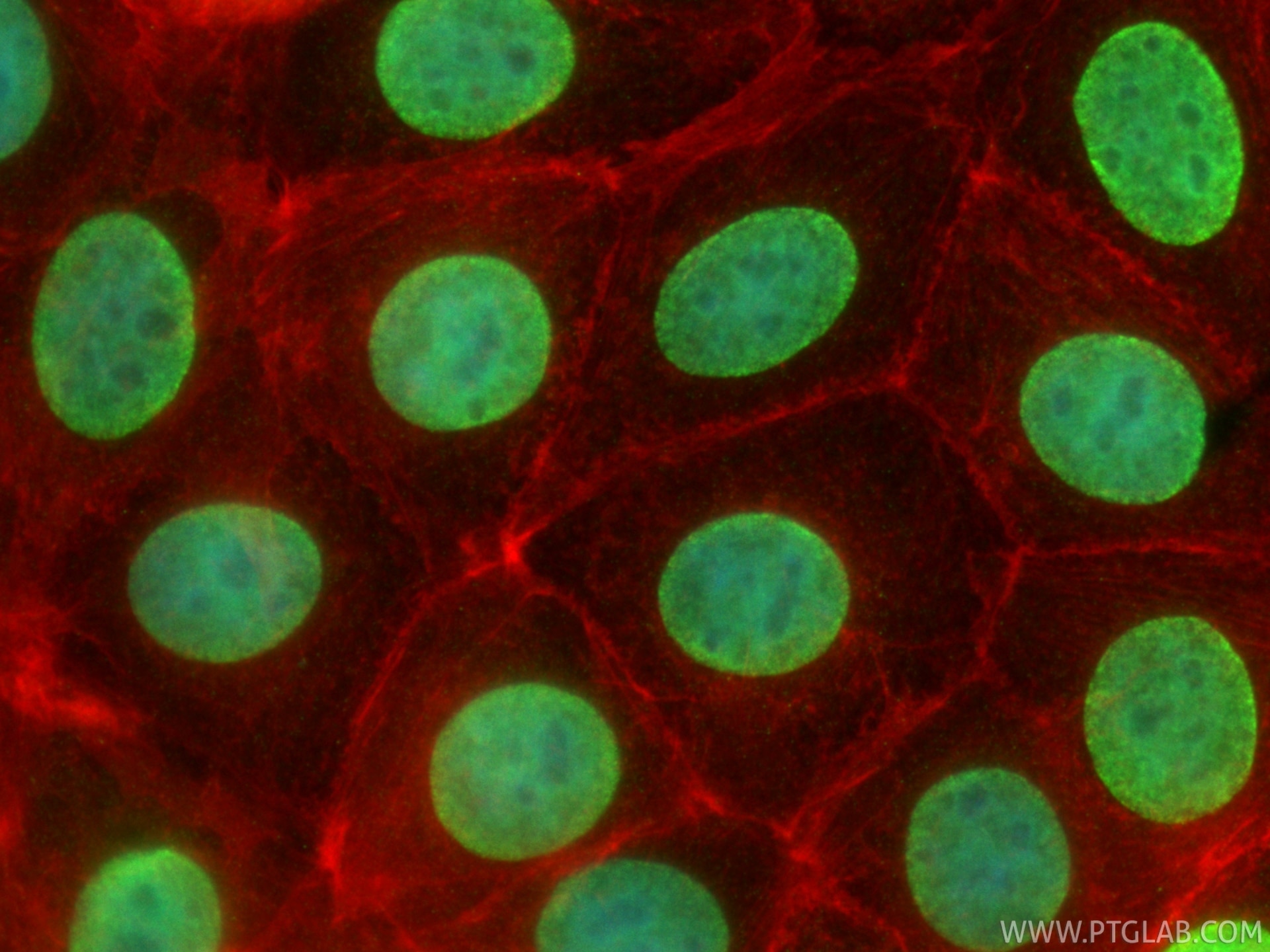 Immunofluorescence (IF) / fluorescent staining of MCF-7 cells using Mono/Di-Methyl-Histone H3 (Lys9) Recombinant monoc (86990-1-RR)
