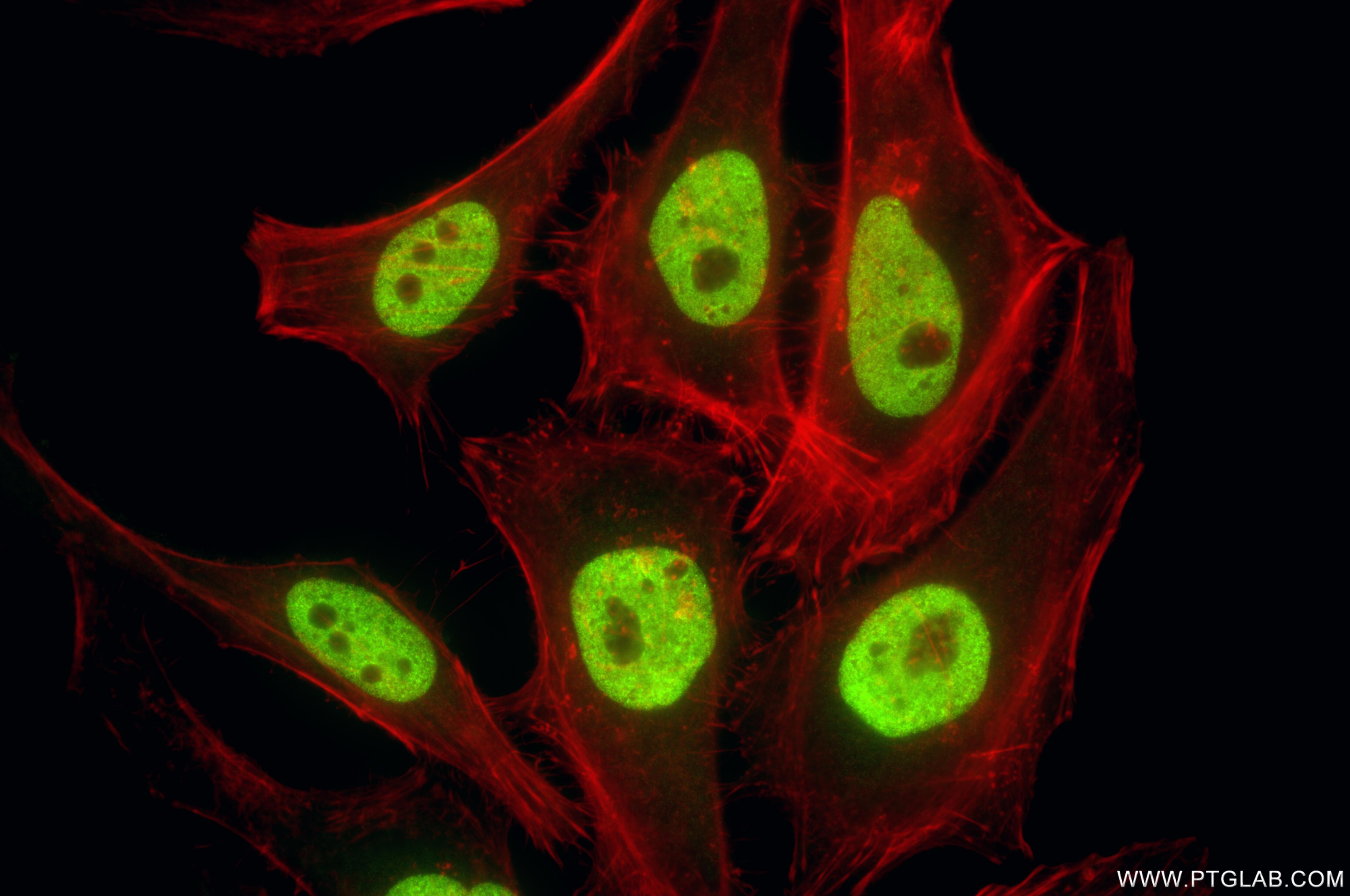 IF Staining of HeLa using 84908-1-RR Immunofluorescence (IF) / fluorescent staining of HeLa cells using Mono/Di/Tri-Methyl-Histone H3 (Lys4) Recombinant m (84908-1-RR)