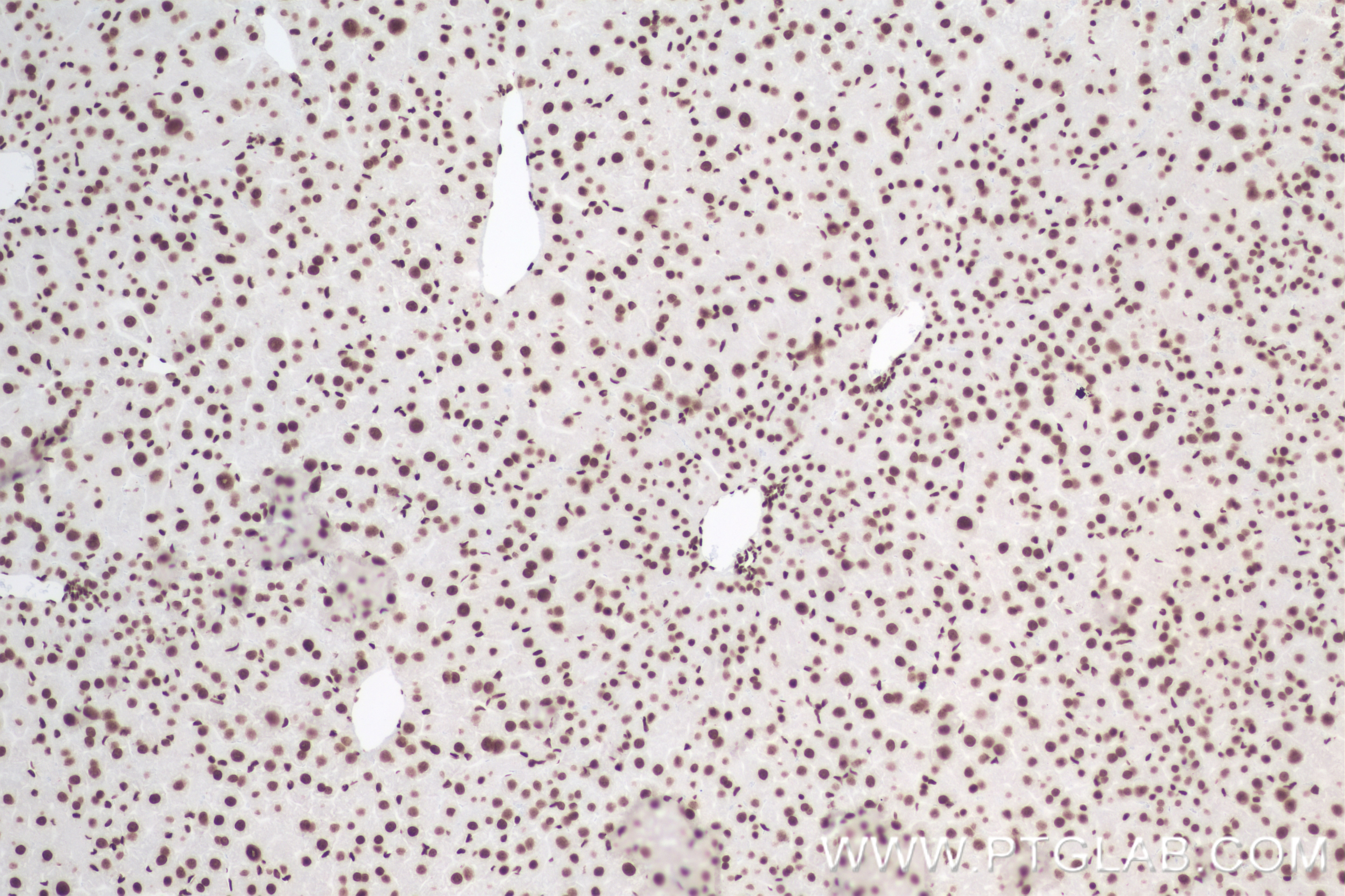 Immunohistochemistry (IHC) staining of mouse liver tissue using Mono/Di/Tri-Methyl-Histone H3 (Lys4) Recombinant a (84908-1-RR)